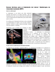 Radioterapia de Intensidad Modulada