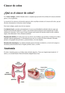cancer de colon