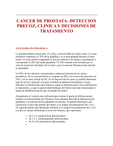 deteccion precoz del cancer de prostata