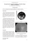 Neuropatía óptica isquémica no arterítica y sildenafilo (Viagra