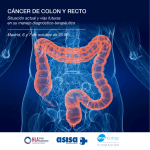 cáncer de colon y recto