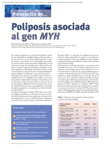 Poliposis asociada al gen MYH