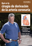 Qué es la cirugía de derivación de la arteria coronaria