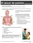 El cáncer de pulmón Hoja informativa