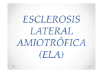 Esclerosis Lateral Amiotrofica