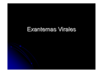 Exantemas Virales - Centro de Salud. Bollullos del Condado