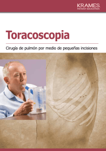 Toracoscopia - Veterans Health Library