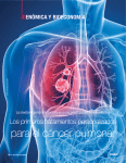 para el cáncer pulmonar - Global Biotech Consulting Group