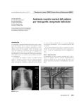 Anatomía vascular normal del pulmón por tomografía