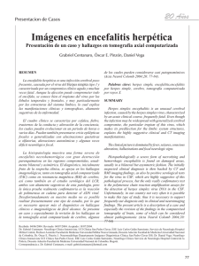 Imágenes en encefalitis herpética