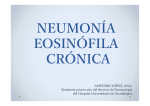 09_Neumonía eosinófila crónica.