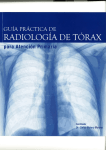 Radiología del tórax