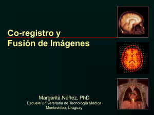 Co-registro de im&aacute;genes