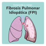 Fibrosis Pulmonar Idiopática (FPI)
