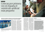 Colocan por primera vez en España el ventrículo artificial más