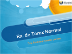 Rx. de Tórax Normal