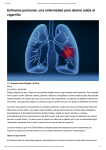 Enfisema pulmonar, una enfermedad para decirle adiós al cigarrillo