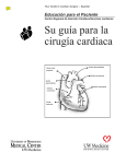 Su guía para la cirugía cardiaca - UWMC Health On-Line