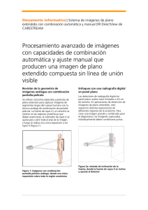Folleto de radiografía de gran longitud DR
