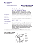 Estudio Electrofisiológico (EPS, por sus siglas en inglés)