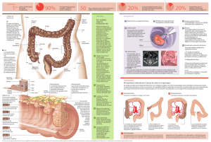 Descargar infográfico - Clínica Universidad de Navarra