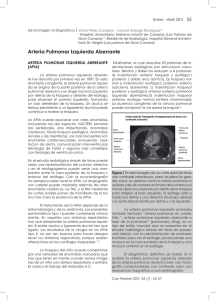 De la imagen al diagnóstico: Arteria pulmonar izquierda aberrante