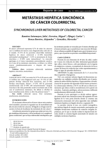 MeTáSTASiS HePáTiCA SiNCrÓNiCA de CáNCer ColorreCTAl