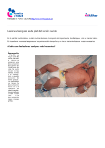 Lesiones benignas en la piel del recién nacido