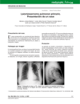 Leiomiosarcoma pulmonar primario.Presentación de
