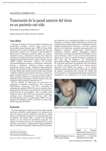 Tumoraci&oacute;n de la pared anterior del t&oacute;rax en un paciente con sida