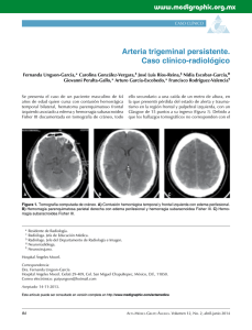 Arteria trigeminal persistente. Caso clínico-radiológico
