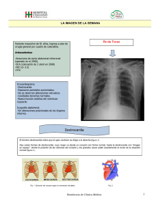 Dextrocardia - Hospital Italiano