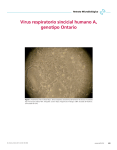 Virus respiratorio sincicial humano A, genotipo Ontario