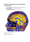Hacia la estimulación cerebral profunda sin