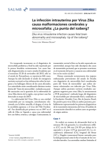 La infección intrauterina por Virus Zika causa malformaciones