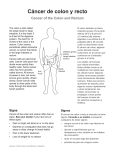 Cancer of the Colon and Rectum - Spanish