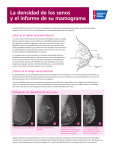 Breast Density and Your Mammogram Report Handout Spanish