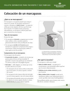 Colocación de un marcapasos