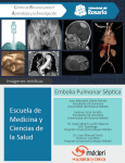 Embolia Pulmonar Séptica - Universidad del Rosario