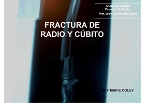 Fracturas de Radio.