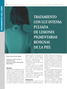 tratamiento con luz intensa pulsada de lesiones
