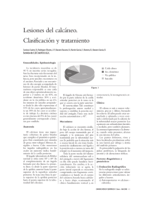 Lesiones del calcáneo. Clasificación y tratamiento