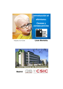 Introducción al albinismo: Causas y consecuencias - CNB