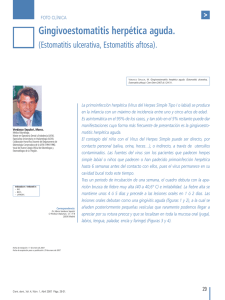 Gingivoestomatitis herpética aguda.