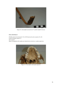 Figura 53: Extremidad esternal de la 4ª costilla. EstadioV de Iscan