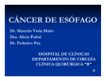 cáncer de esófago - Clínica Quirúrgica B