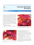 Anatomía Quirúrgica del Ovario