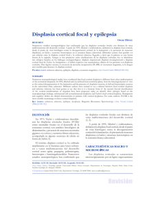 Displasia cortical focal y epilepsia