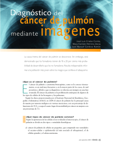 Diagnóstico del cáncer de pulmón mediante