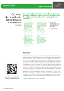Carcinoma ductal infiltrante, el tipo de cáncer de mama más común